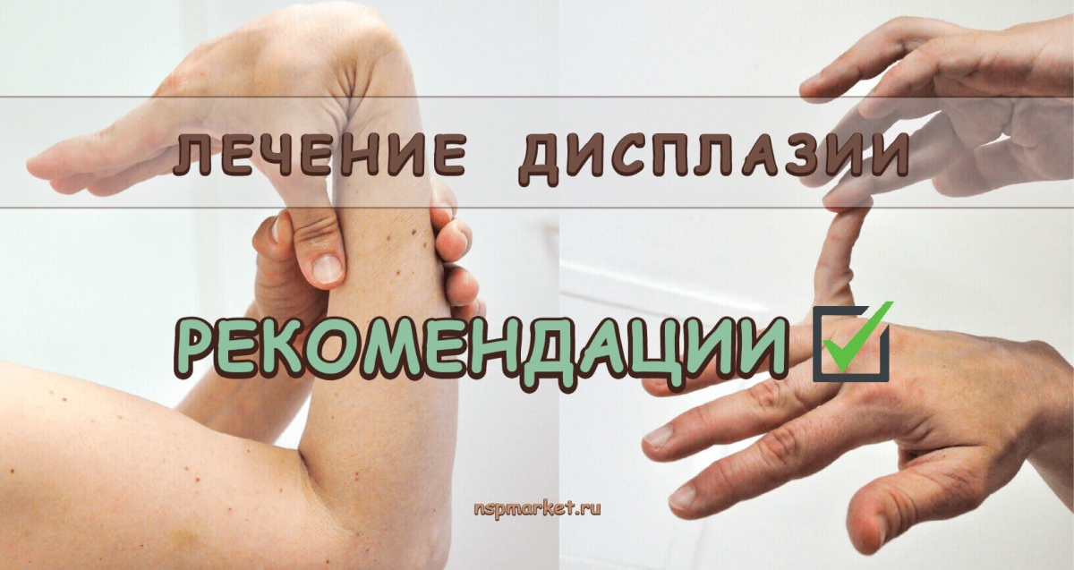 Дисплазия соединительной ткани. Лечение дисплазия у детей и взрослых