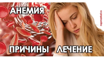 Анемия - лечение у детей и взрослых