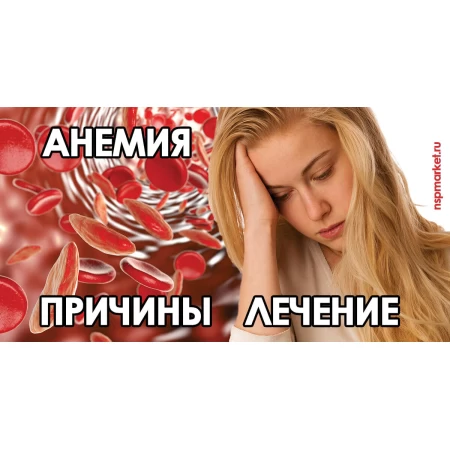 Анемия - лечение у детей и взрослых