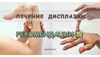 Лечение дисплазия у детей и взрослых