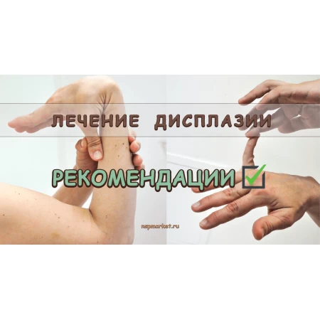 Лечение дисплазия у детей и взрослых